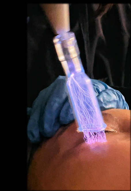 Fusion Cold Plasma 6 In 1 Beauty Machine