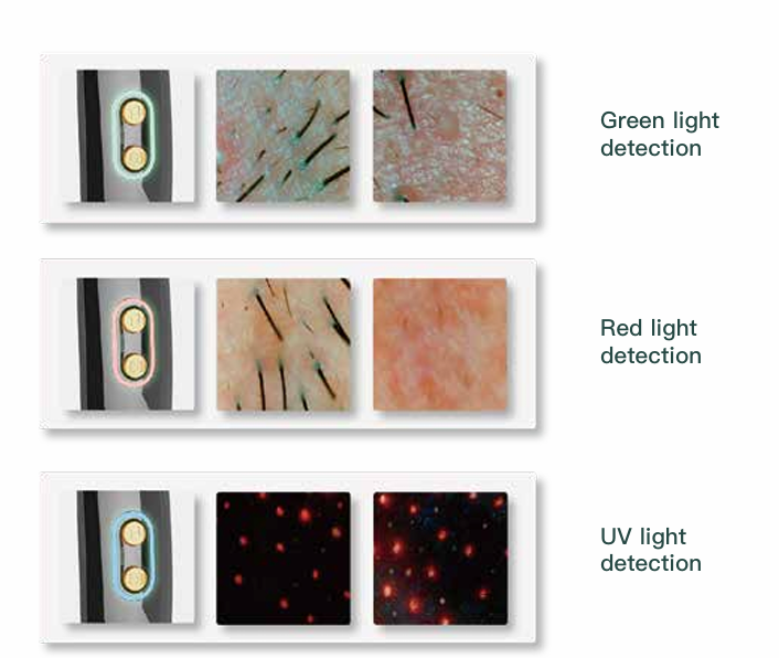 AI Intelligent 50x Skin Analyzer System