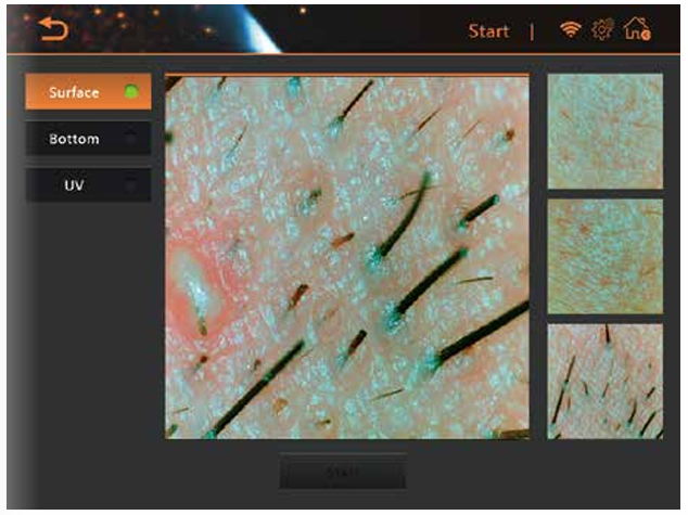 AI Intelligent 50x Skin Analyzer System