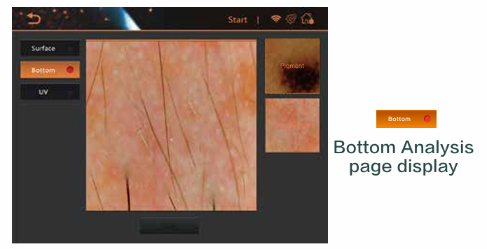 AI Intelligent 50x Skin Analyzer System