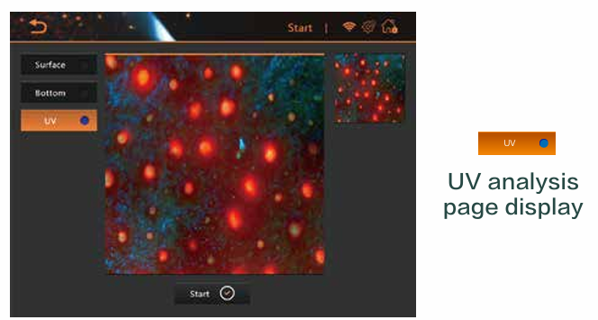 AI Intelligent 50x Skin Analyzer System