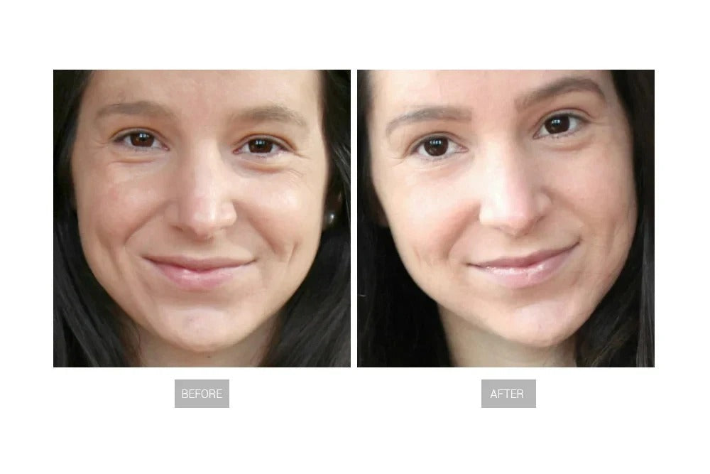EMS Face Lifting Machine Facial Muscle Sculpting Skin Tightening Device